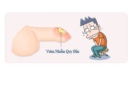 chu-y-khi-chua-viem-bao-quy-dau