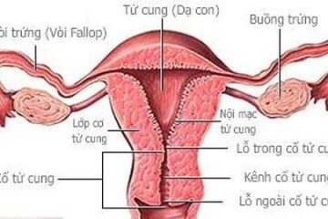 Tắc vòi trứng là nguyên nhân hàng đầu gây vô sinh