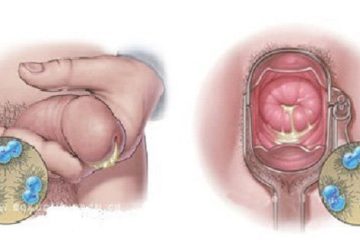 [Bật mí] Cách nhận biết dấu hiệu bệnh lậu ở nam và nữ giới