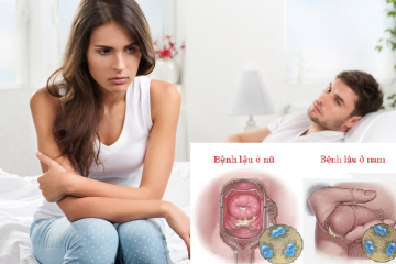 [ Chia sẻ ] 6+ Nguyên nhân bệnh lậu các bạn cần phải biết