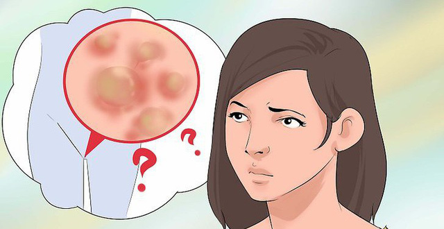 Dấu hiệu viêm âm đạo