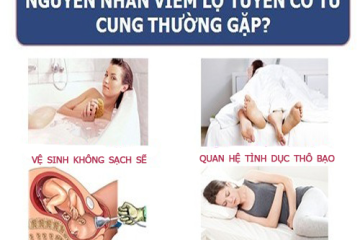 [ Hé lộ] 8+ Nguyên nhân viêm lộ tuyến cổ tử cung ở chị em phụ nữ
