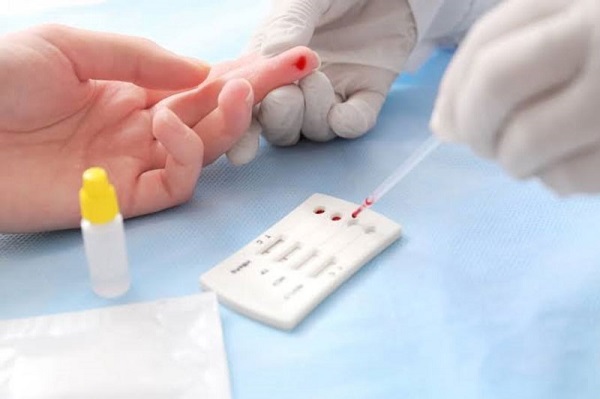 Dấu hiệu bệnh giang mai