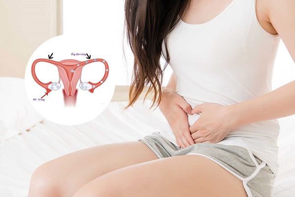 Dấu hiệu viêm vòi trứng