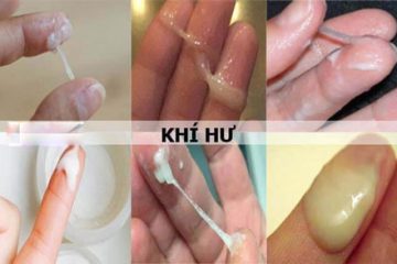 [Giải Đáp ] Khí hư có mùi hôi- Cùng B.S CK II Vũ Thị Thanh Dung