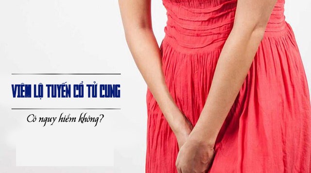 địa chỉ điều trị viêm lộ tuyến cổ tử cung