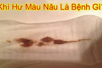 [ Hỏi – Đáp ]  Ra khí hư nâu cùng các bác sĩ chuyên khoa giàu kinh nghiệm
