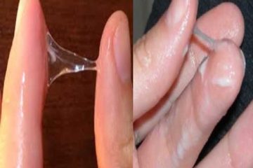 Khí hư và huyết trắng khác nhau như thế nào? [Nghe chuyên gia giải đáp]