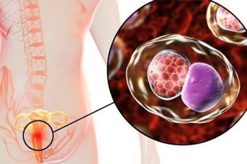 Bệnh lậu giai đoạn đầu: Dấu hiệu nhận biết và cách điều trị
