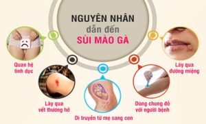 Nguyên nhân dẫn đến sùi mào gà