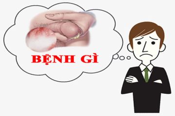 [ Dương vật bị đau và chảy mủ] Cảnh báo những bệnh lý nguy hiểm