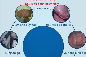 [ Nam giới cần biết] Hình ảnh dương vật nổi mụn của từng bệnh lí