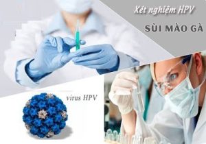 Địa chỉ khám chữa sùi mào gà uy tín ở TPHCM