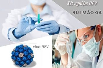 [Chuyên gia giải đáp] Xét nghiệm máu có ra bệnh sùi mào gà không?