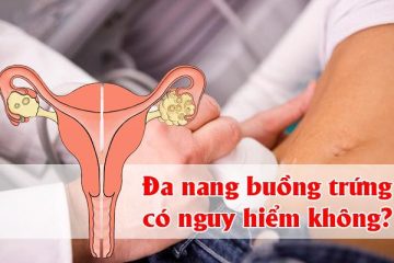 [Chuyên gia giải đáp] Bệnh đa nang buồng trứng có nguy hiểm không?