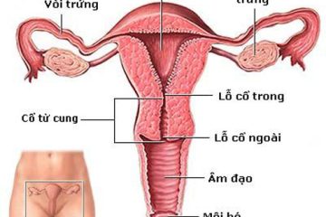 Cổ tử cung ngắn