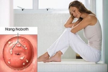 Nang naboth cổ tử cung 6mm có nguy hiểm không? Chữa như thế nào ?