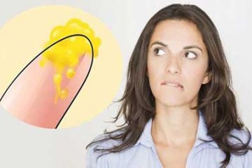 Ngứa vùng kín khí hư màu vàng- Giải đáp từ các chuyên gia
