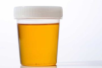 Tiểu buốt nước tiểu vàng là triệu chứng của bệnh gì?