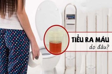 [Tiểu ra máu hồng nhạt là bị làm sao?] Cảnh báo nhiều bệnh lý nguy hiểm