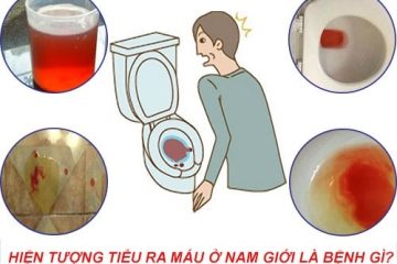 [Tiểu buốt ra máu ở nam]- Những điều anh em nam giới cần biết