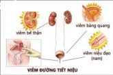[ 2026 ]Chi phí chữa viêm đường tiết niệu hết bao nhiêu tiền?